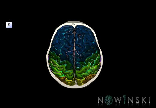 G8.T3.1-15.2-22.2 22.6.V5.C4-2.L0.Cerebrum-Intracranial arteries-Neurocranium-No skull top
