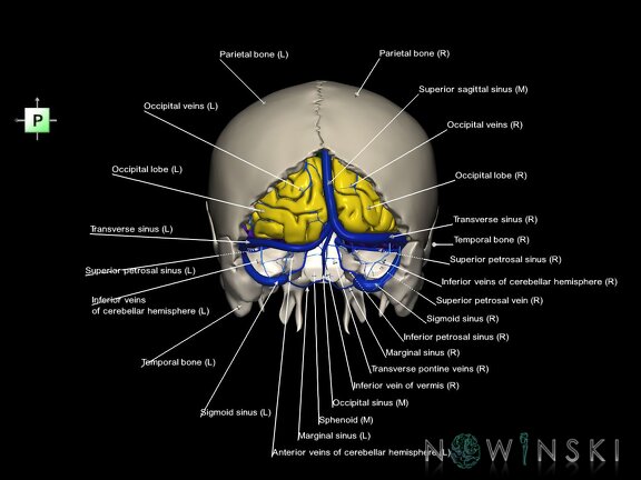 G8.T3.1-16.1-22.2 22.5.6.V3.C2.L1.Cerebrum-Intracranial venous system-Neurocranium-No occipital bone