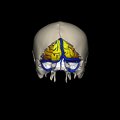 G8.T3.1-16.1-22.2 22.5.6.V3.C4-2.L0.Cerebrum-Intracranial venous system-Neurocranium-No occipital bone