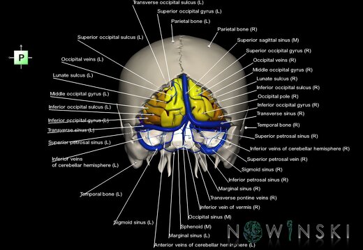 G8.T3.1-16.1-22.2 22.5.6.V3.C4-2.L1.Cerebrum-Intracranial venous system-Neurocranium-No occipital bone