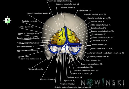 G8T3.1-16.1-22.2.CerebrumIntraVenousSysNeurocraniumOpen