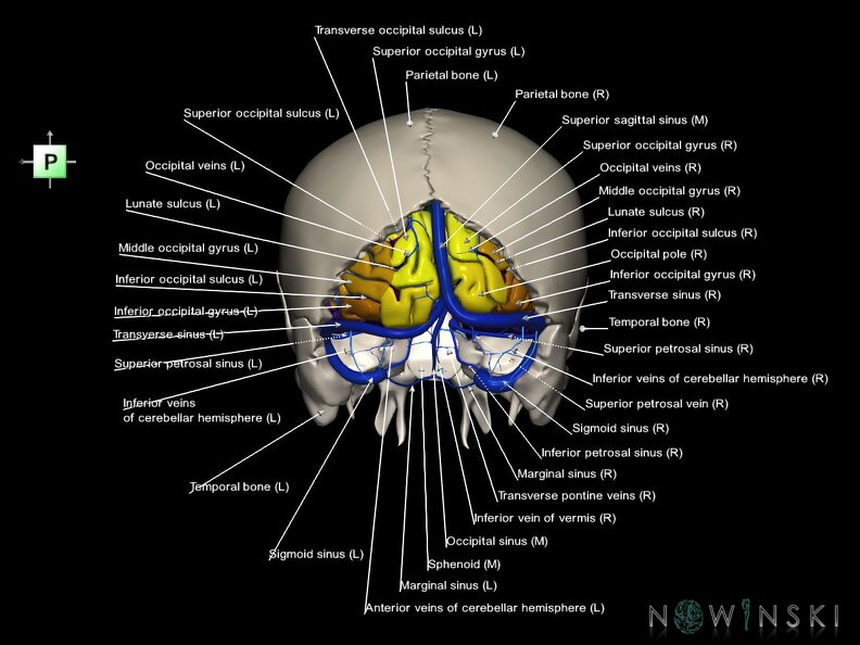 G8.T3.1-16.1-22.2 22.5.6.V3.C4-2.L1.Cerebrum-Intracranial venous system-Neurocranium-No occipital bone