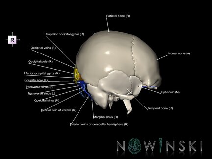 G8.T3.1-16.1-22.2 22.5.6.V4.C3-2.L1.Cerebrum-Intracranial venous system-Neurocranium-No occipital bone