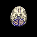 G8.T3.1-16.1-22.2 22.5.6.V6.C1.L0.Cerebrum-Intracranial venous system-Neurocranium-No occipital bone