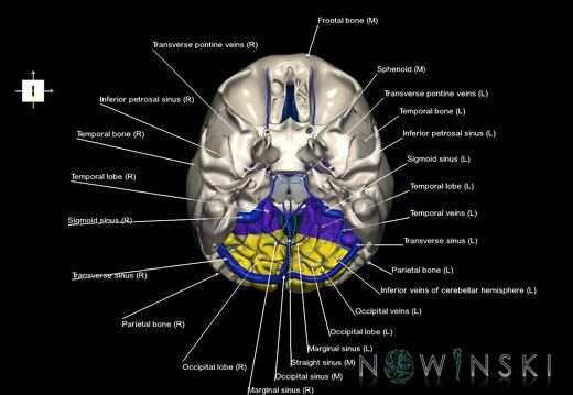 G8.T3.1-16.1-22.2 22.5.6.V6.C2.L1.Cerebrum-Intracranial venous system-Neurocranium-No occipital bone