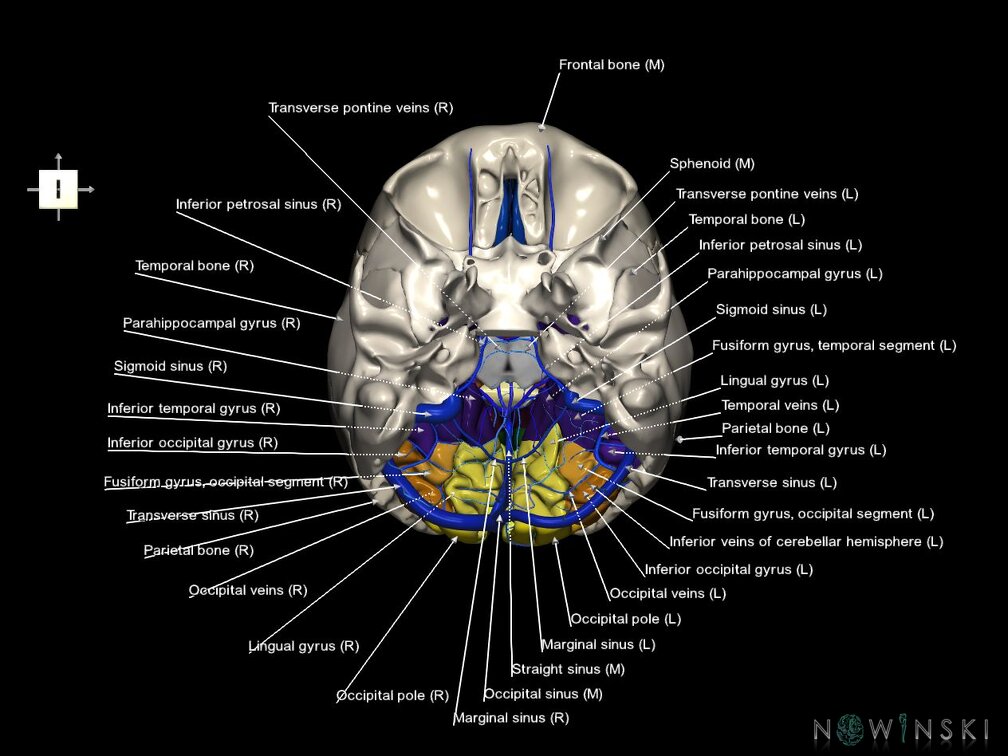 G8.T3.1-16.1-22.2 22.5.6.V6.C3-2.L1.Cerebrum-Intracranial venous system-Neurocranium-No occipital bone