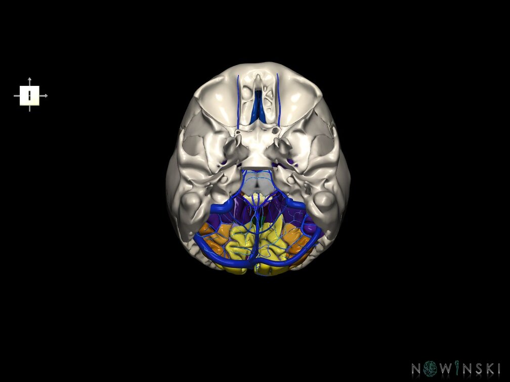 G8.T3.1-16.1-22.2 22.5.6.V6.C4-2.L0.Cerebrum-Intracranial venous system-Neurocranium-No occipital bone