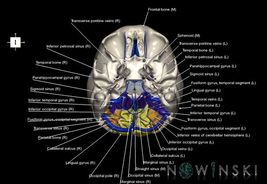 G8.T3.1-16.1-22.2 22.5.6.V6.C4-2.L1.Cerebrum-Intracranial venous system-Neurocranium-No occipital bone