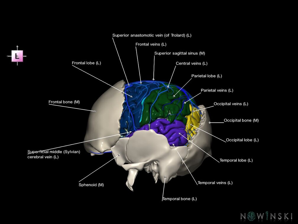 G8.T3.1-16.1-22.2 22.5.7.V2.C2.L1.Cerebrum-Intracranial venous system-Neurocranium-No parietal bone