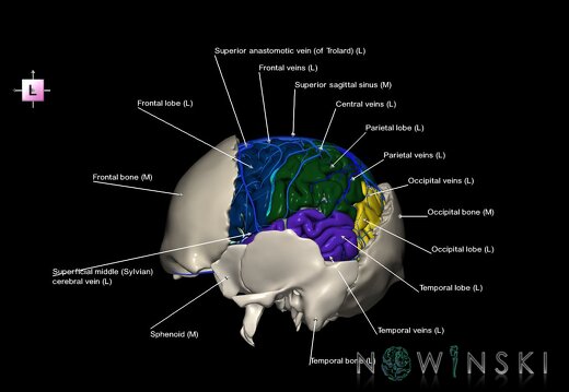 G8.T3.1-16.1-22.2 22.5.7.V2.C2.L1.Cerebrum-Intracranial venous system-Neurocranium-No parietal bone