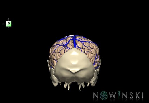 G8.T3.1-16.1-22.2 22.5.7.V3.C1.L0.Cerebrum-Intracranial venous system-Neurocranium-No parietal bone