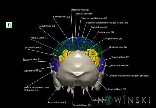 G8.T3.1-16.1-22.2 22.5.7.V3.C2.L1.Cerebrum-Intracranial venous system-Neurocranium-No parietal bone