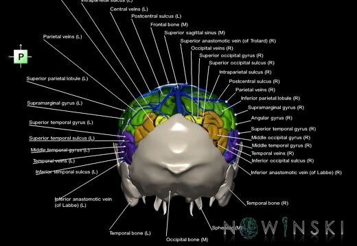 G8.T3.1-16.1-22.2 22.5.7.V3.C4-2.L1.Cerebrum-Intracranial venous system-Neurocranium-No parietal bone