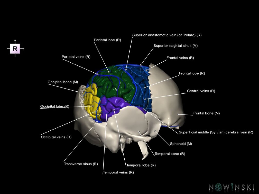 G8.T3.1-16.1-22.2 22.5.7.V4.C2.L1.Cerebrum-Intracranial venous system-Neurocranium-No parietal bone