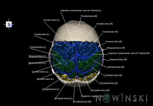 G8.T3.1-16.1-22.2 22.5.7.V5.C2.L1.Cerebrum-Intracranial venous system-Neurocranium-No parietal bone