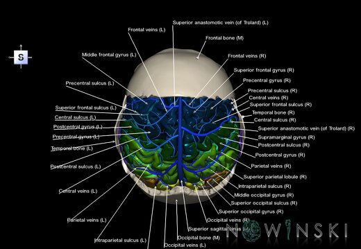 G8.T3.1-16.1-22.2 22.5.7.V5.C4-2.L1.Cerebrum-Intracranial venous system-Neurocranium-No parietal bone