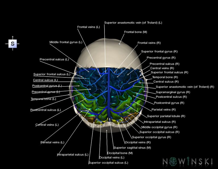 G8.T3.1-16.1-22.2_22.5.7.V5.C4-2.L1.Cerebrum-Intracranial_venous_system-Neurocranium-No_parietal_bone.tiff