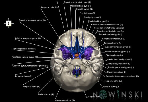 G8.T3.1-16.1-22.2 22.5.8.V6.C3-2.L1.Cerebrum-Intracranial venous system-Neurocranium-No sphenoid