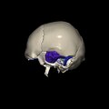G8.T3.1-16.1-22.2 22.5.9.V2.C2.L0.Cerebrum-Intra venous system-Neurocranium-No temporal bone
