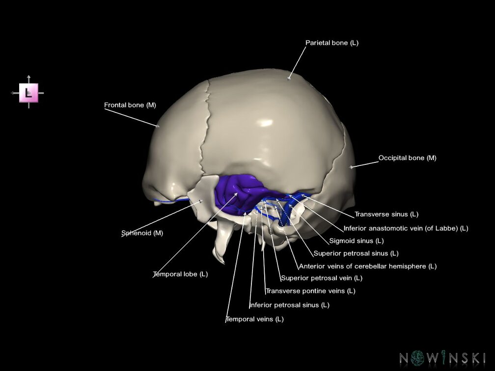 G8.T3.1-16.1-22.2 22.5.9.V2.C2.L1.Cerebrum-Intra venous system-Neurocranium-No temporal bone