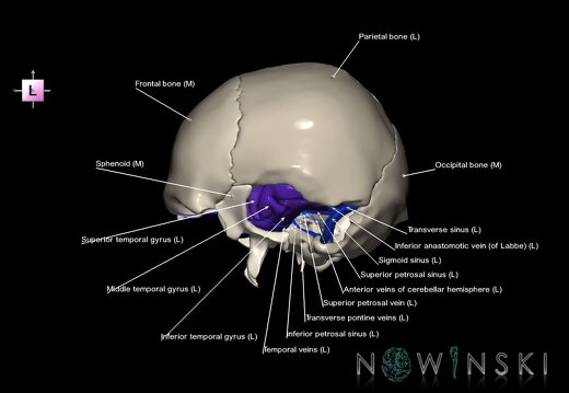 G8.T3.1-16.1-22.2 22.5.9.V2.C3-2.L1.Cerebrum-Intra venous system-Neurocranium-No temporal bone