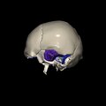 G8.T3.1-16.1-22.2 22.5.9.V2.C4-2.L0.Cerebrum-Intra venous system-Neurocranium-No temporal bone