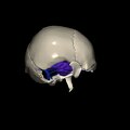G8.T3.1-16.1-22.2 22.5.9.V4.C2.L0.Cerebrum-Intra venous system-Neurocranium-No temporal bone
