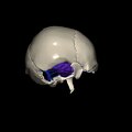 G8.T3.1-16.1-22.2 22.5.9.V4.C3-2.L0.Cerebrum-Intra venous system-Neurocranium-No temporal bone