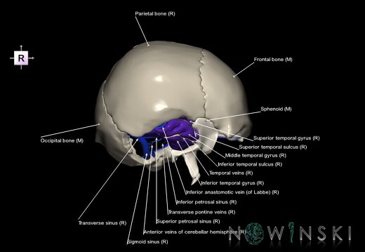 G8.T3.1-16.1-22.2 22.5.9.V4.C4-2.L1.Cerebrum-Intra venous system-Neurocranium-No temporal bone