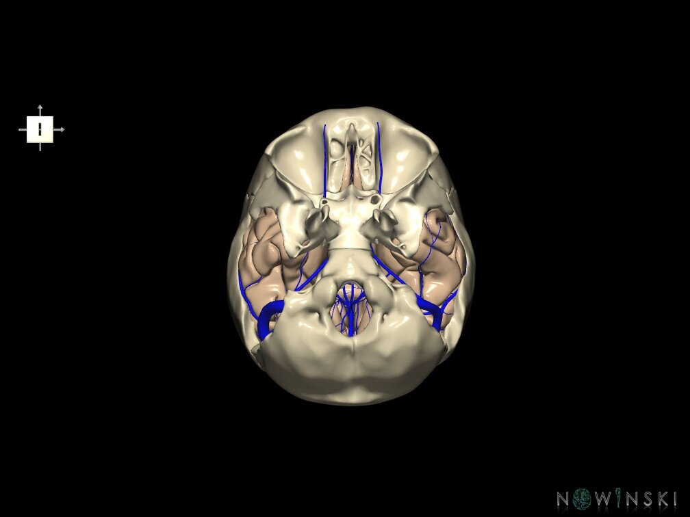 G8.T3.1-16.1-22.2 22.5.9.V6.C1.L0.Cerebrum-Intra venous system-Neurocranium-No temporal bone