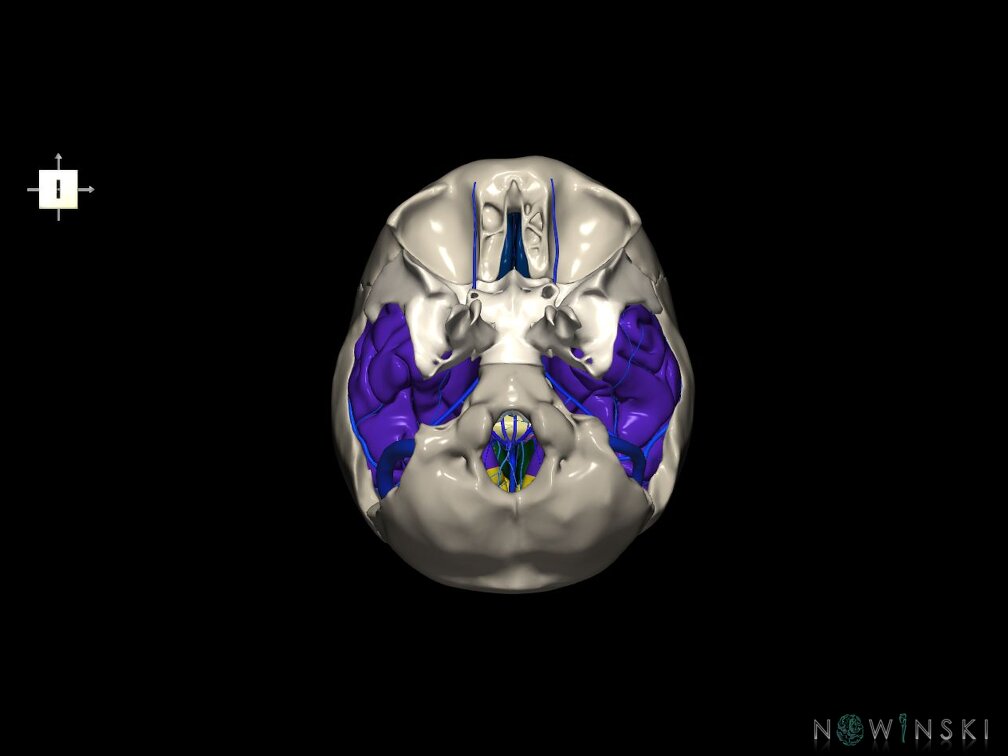 G8.T3.1-16.1-22.2 22.5.9.V6.C2.L0.Cerebrum-Intra venous system-Neurocranium-No temporal bone
