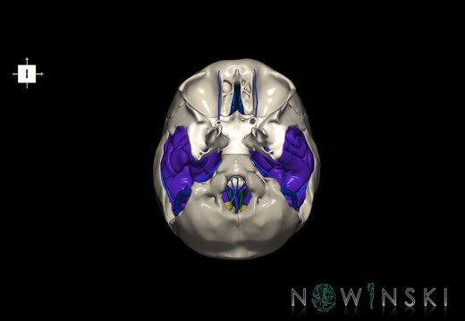 G8.T3.1-16.1-22.2 22.5.9.V6.C2.L0.Cerebrum-Intra venous system-Neurocranium-No temporal bone