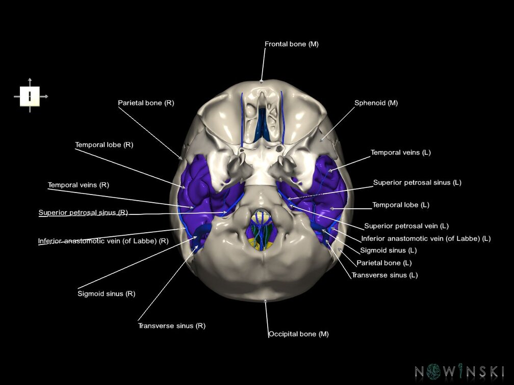 G8.T3.1-16.1-22.2 22.5.9.V6.C2.L1.Cerebrum-Intra venous system-Neurocranium-No temporal bone