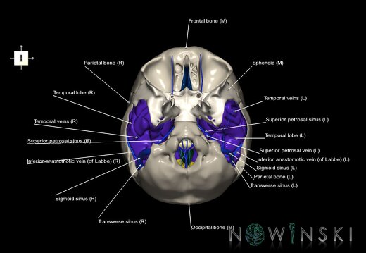 G8.T3.1-16.1-22.2 22.5.9.V6.C2.L1.Cerebrum-Intra venous system-Neurocranium-No temporal bone