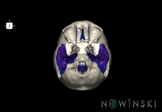 G8.T3.1-16.1-22.2 22.5.9.V6.C3-2.L0.Cerebrum-Intra venous system-Neurocranium-No temporal bone