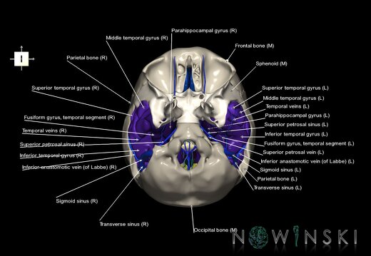G8.T3.1-16.1-22.2 22.5.9.V6.C3-2.L1.Cerebrum-Intra venous system-Neurocranium-No temporal bone