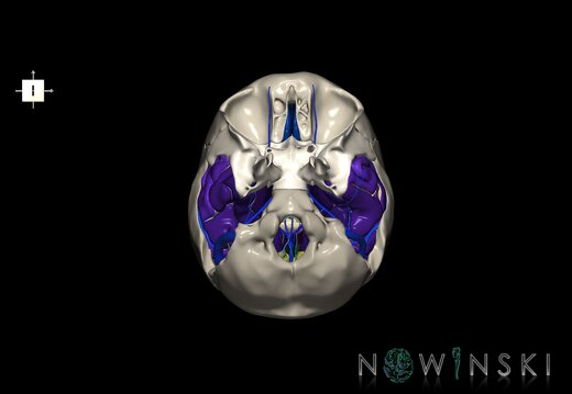 G8.T3.1-16.1-22.2 22.5.9.V6.C4-2.L0.Cerebrum-Intra venous system-Neurocranium-No temporal bone