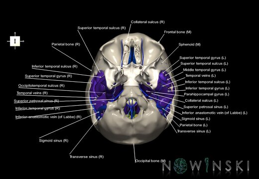 G8.T3.1-16.1-22.2 22.5.9.V6.C4-2.L1.Cerebrum-Intra venous system-Neurocranium-No temporal bone