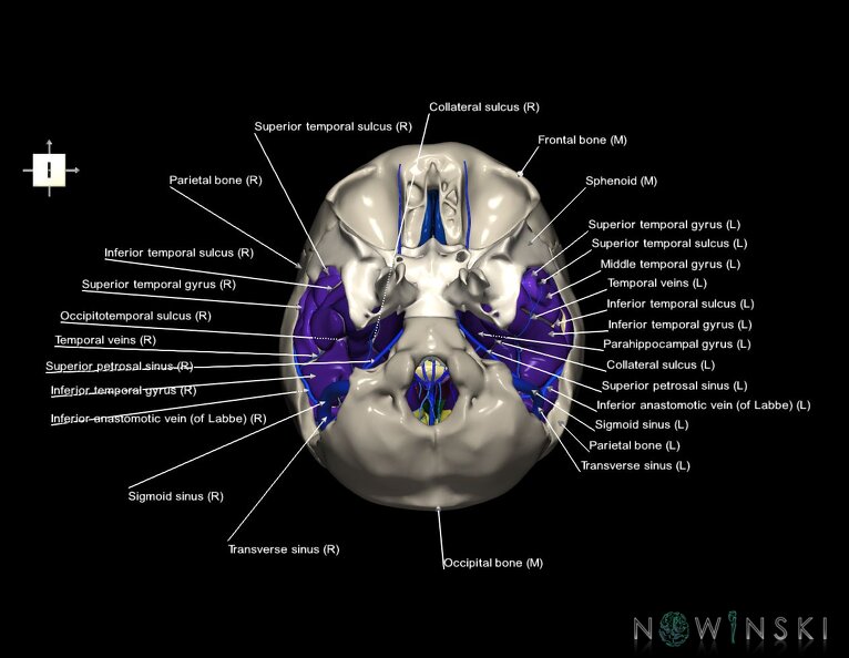 G8.T3.1-16.1-22.2_22.5.9.V6.C4-2.L1.Cerebrum-Intra_venous_system-Neurocranium-No_temporal_bone.tiff