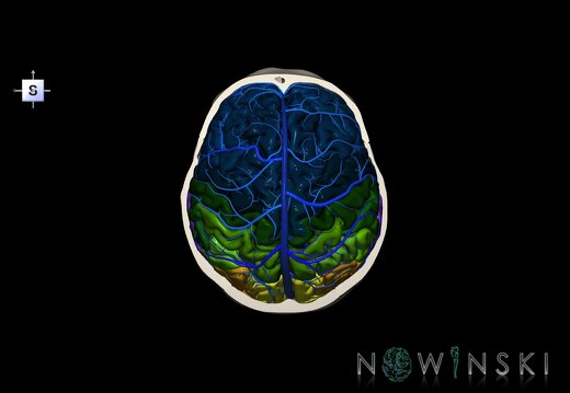 G8.T3.1-16.1-22.2 22.6.V5.C3-2.L0.Cerebrum-Intracranial venous system-Neurocranium-No skull top