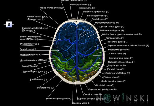 G8.T3.1-16.1-22.2 22.6.V5.C3-2.L1.Cerebrum-Intracranial venous system-Neurocranium-No skull top