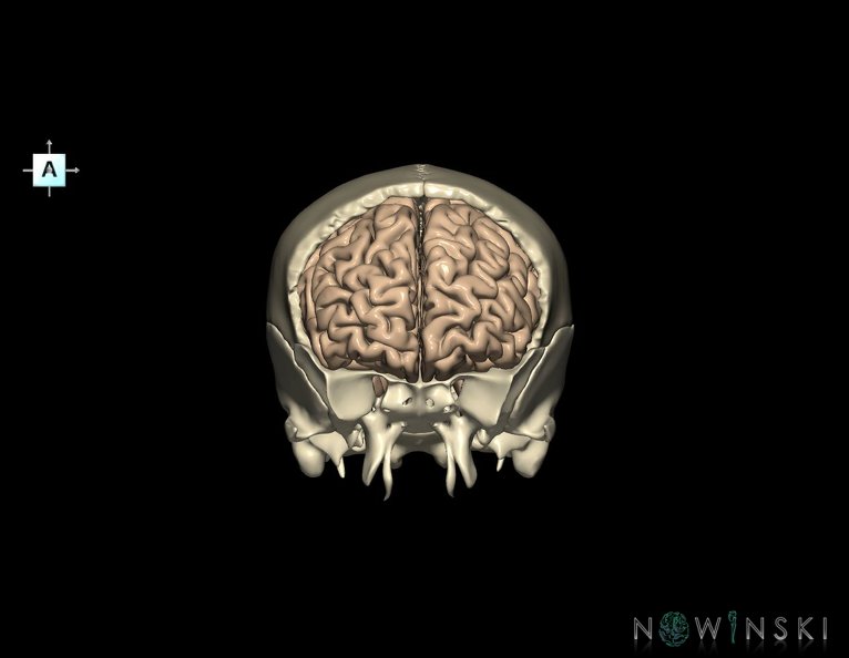 G8.T3.1-22.2_22.5.3.V1.C1.L0.Cerebrum-Neurocranium-No_frontal_bone.tiff