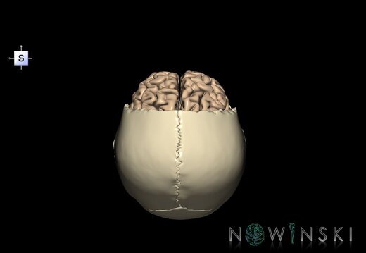 G8.T3.1-22.2 22.5.3.V5.C1.L0.Cerebrum-Neurocranium-No frontal bone