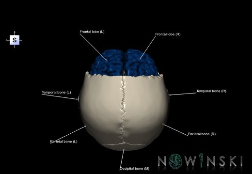 G8.T3.1-22.2 22.5.3.V5.C2.L1.Cerebrum-Neurocranium-No frontal bone