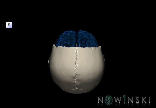 G8.T3.1-22.2 22.5.3.V5.C3-2.L0.Cerebrum-Neurocranium-No frontal bone