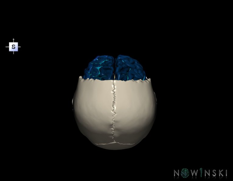 G8.T3.1-22.2_22.5.3.V5.C4-2.L0.Cerebrum-Neurocranium-No_frontal_bone.tiff