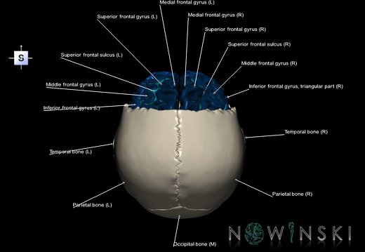 G8.T3.1-22.2 22.5.3.V5.C4-2.L1.Cerebrum-Neurocranium-No frontal bone