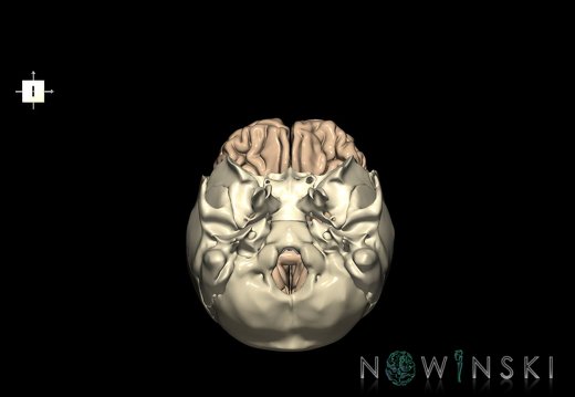 G8.T3.1-22.2 22.5.3.V6.C1.L0.Cerebrum-Neurocranium-No frontal bone