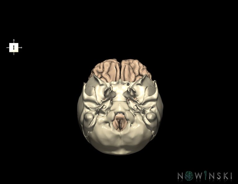 G8.T3.1-22.2_22.5.3.V6.C1.L0.Cerebrum-Neurocranium-No_frontal_bone.tiff