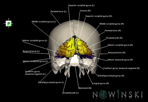 G8.T3.1-22.2 22.5.6.V3.C3-2.L1.Cerebrum-Neurocranium-No occipital bone